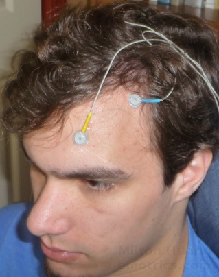 photo of man with electrodes on forehead